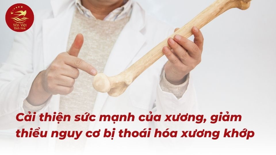 Hỗ trợ sức khỏe xương