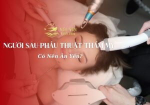 Người Sau Phẫu Thuật Thẩm Mỹ Có Nên Ăn Yến