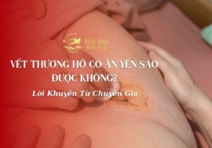 Vết Thương Hở Có Ăn Yến Sào Được Không?